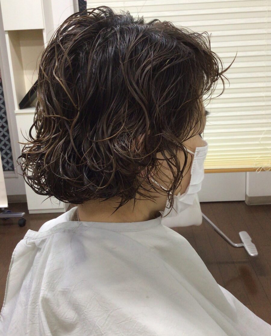 リブカール施術後