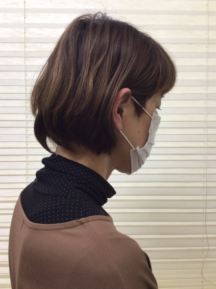 リブカール施術前